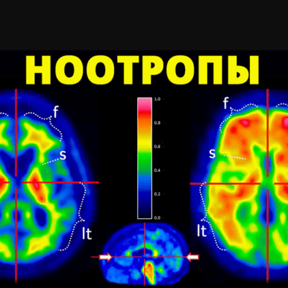 [Дмитрий Райз] Ноотропы и разгон мозга 10 дней высоких результатов (2021)