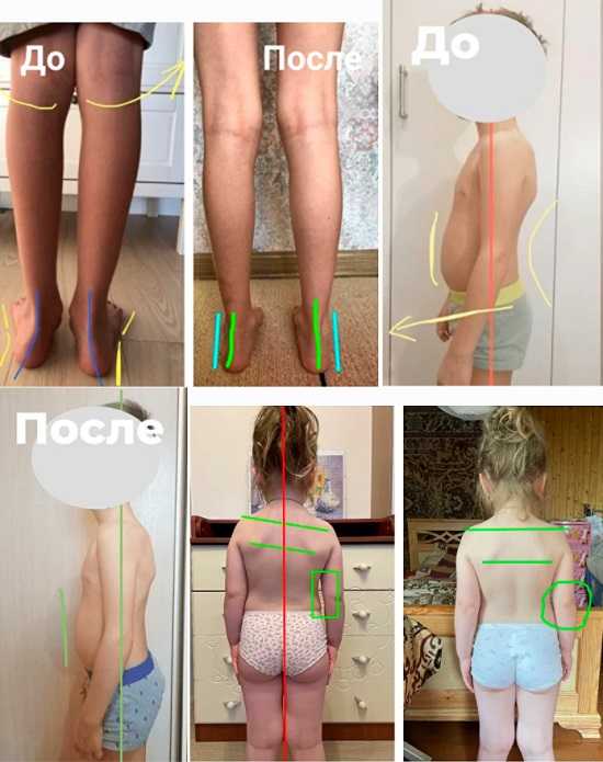 [Юлия Маркелова] Здоровые стопы и осанка за лето. Курс оздоровительных упражнений для детей 4-12 лет (2021)