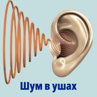[Оверченко К. В. Борисов А. С.] Все о шуме в ушах видеогайд (2023)