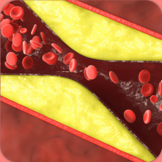 [Валерий Подрубаев] Инфаркт, статины, холестерин - сложнее, чем мы думали (2025) [Humberto 2.0] [Первый тариф]