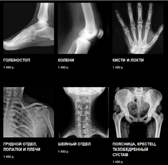 [Виктор Блуд, доктор Демченко Владимир] Полный ЛФК курс (2023)