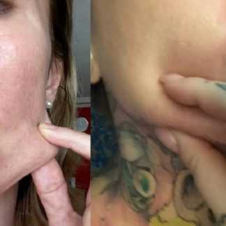 [Ярослава Науменко] Гормон роста – гормон жиросжигания и кожи без морщин (2025)