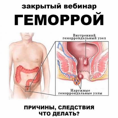 [Женя Братишка, Юля Братишка] Геморрой (2024) [pravda.pro.pisheprom]